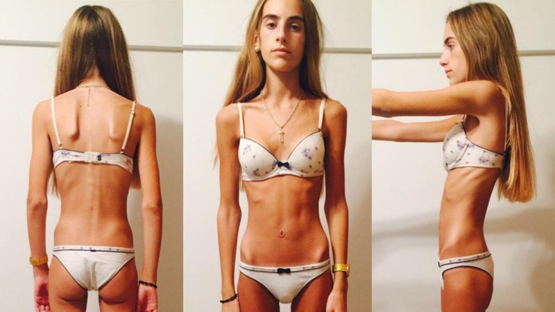 Skinny with small breasts