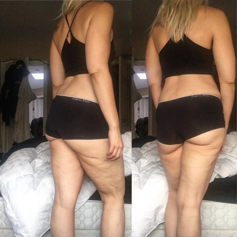 Cellulite women at sea