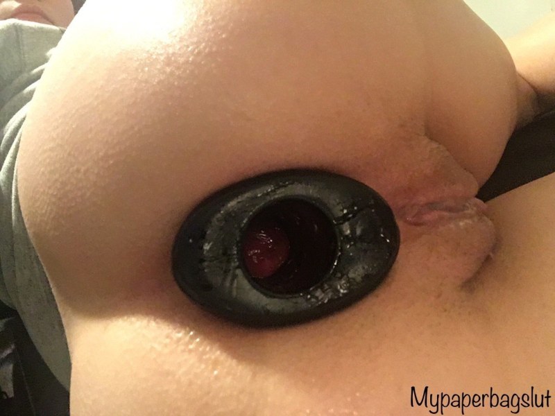 The anal tunnel is large