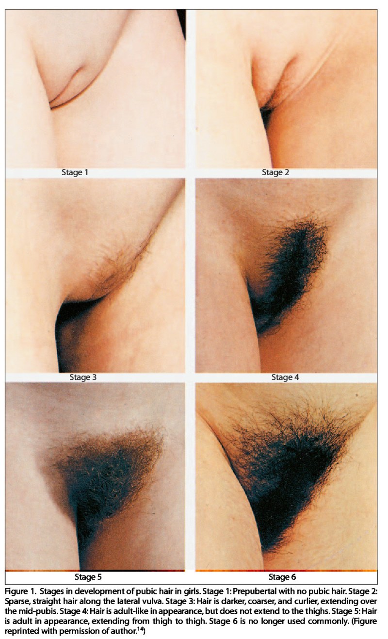 Gloval of female pubis
