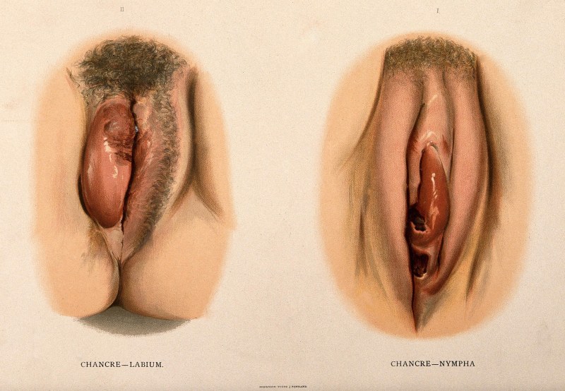 Women's sexual genitals