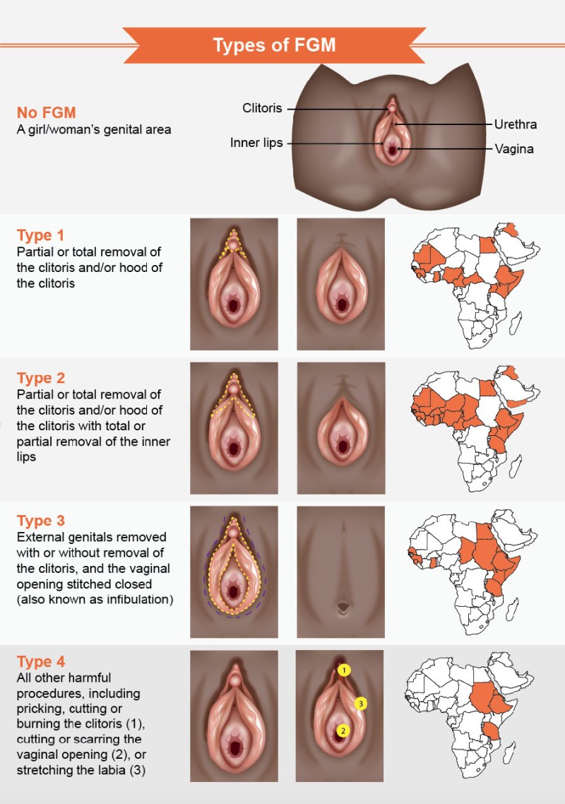 Pathologies of female genitals