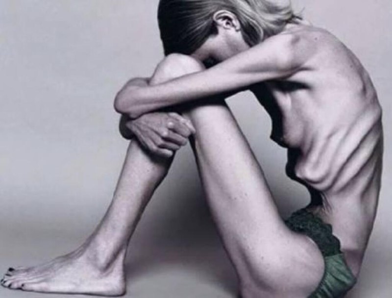 Cachectic anorexia