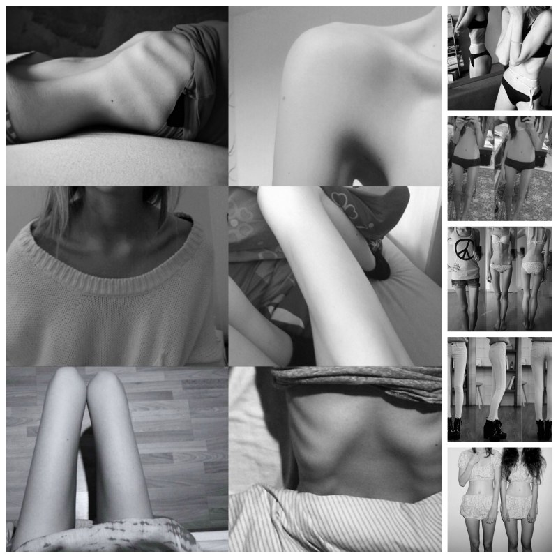 Anorexia on catwalk