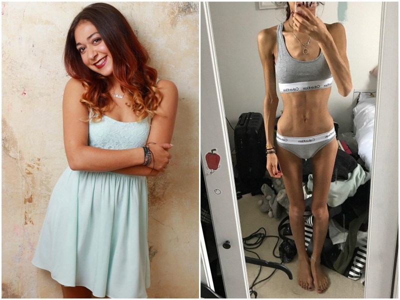 Cute selfies anorexic