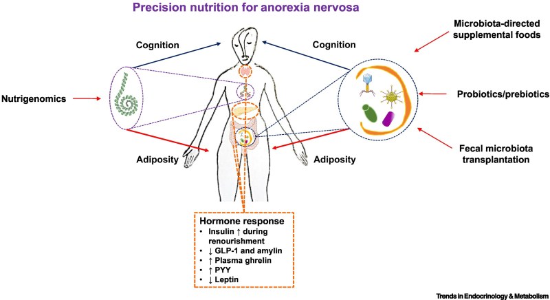 Lina Ezhevskaya anorexica