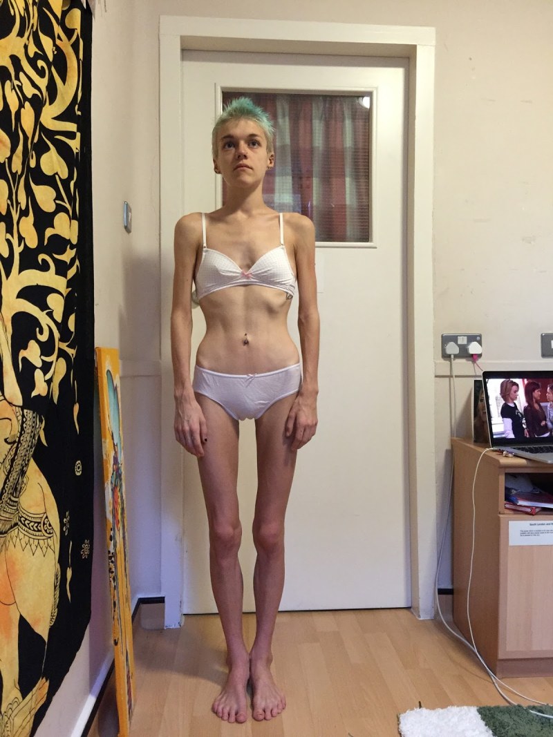 Pars nervosa translation