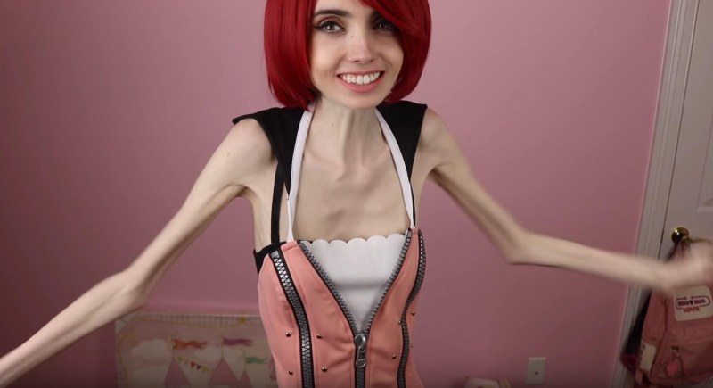 Anorexic Japanese
