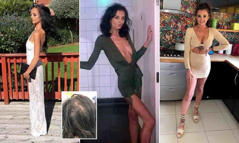 Anorexica in underwear