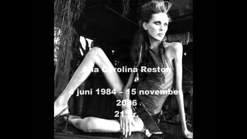 Khilkevich Anna Anorexia Anorexia