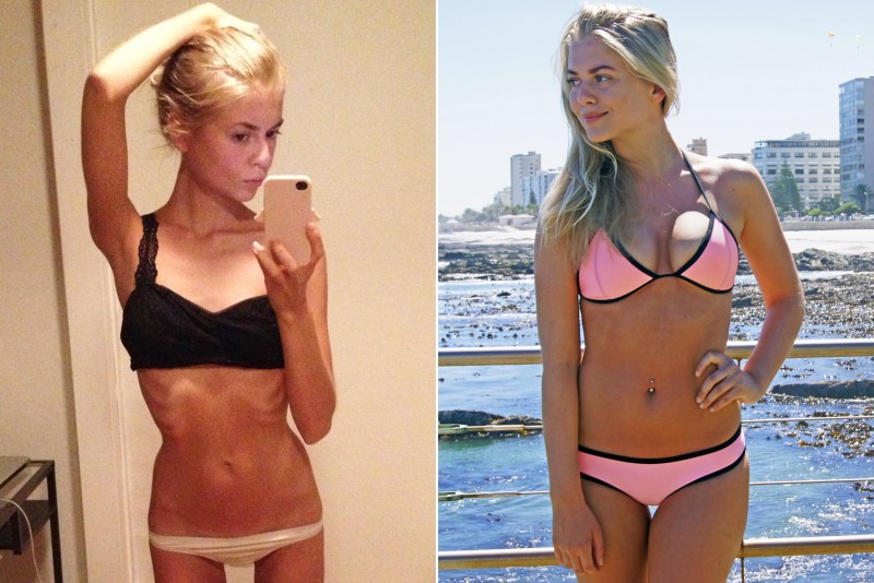 Blonde anorexic actress