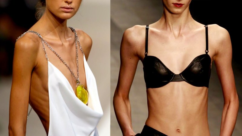 Anorexia nervous syndrome