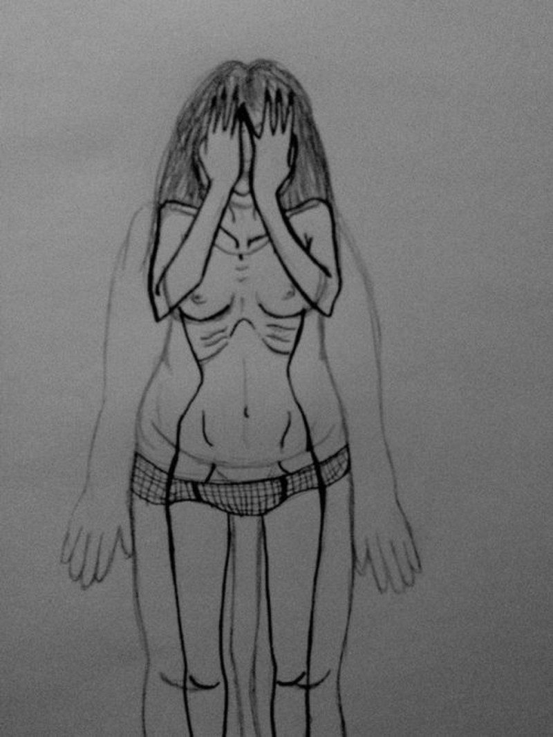 Nervous anorexia Jessica Parker