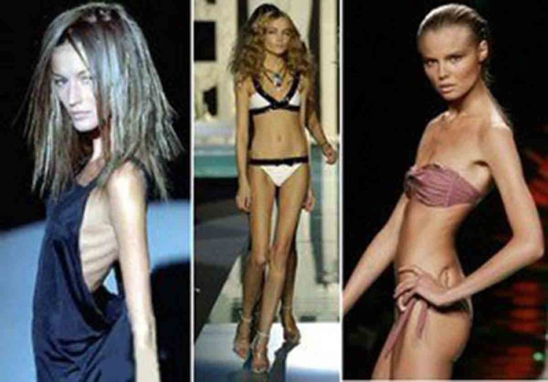 Dasha Parkhomenko anorexia