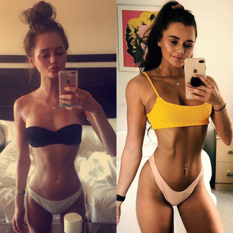 The ribs of the girl