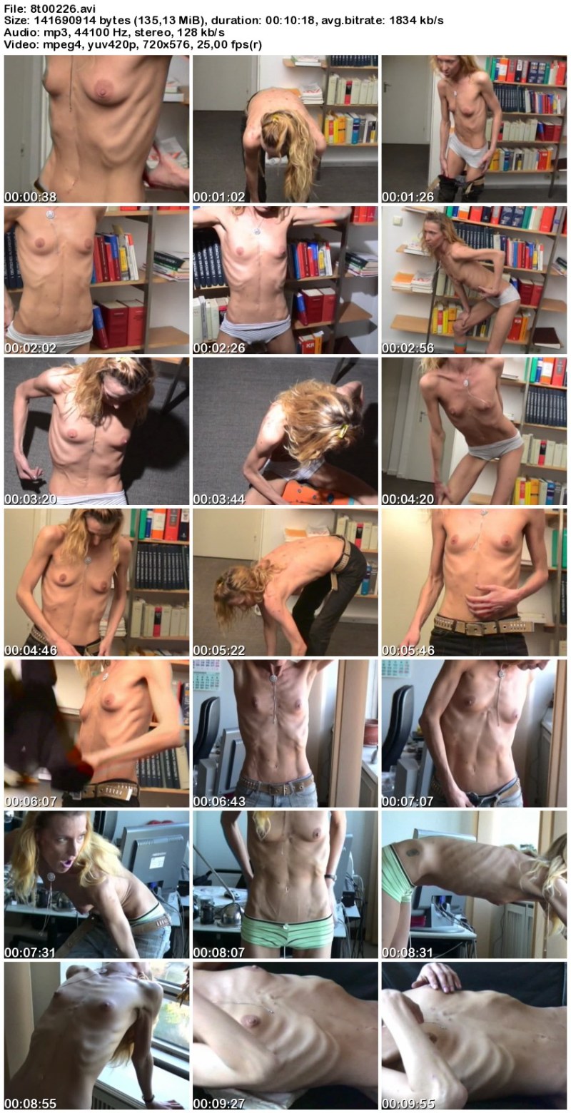 Fully naked anorexics