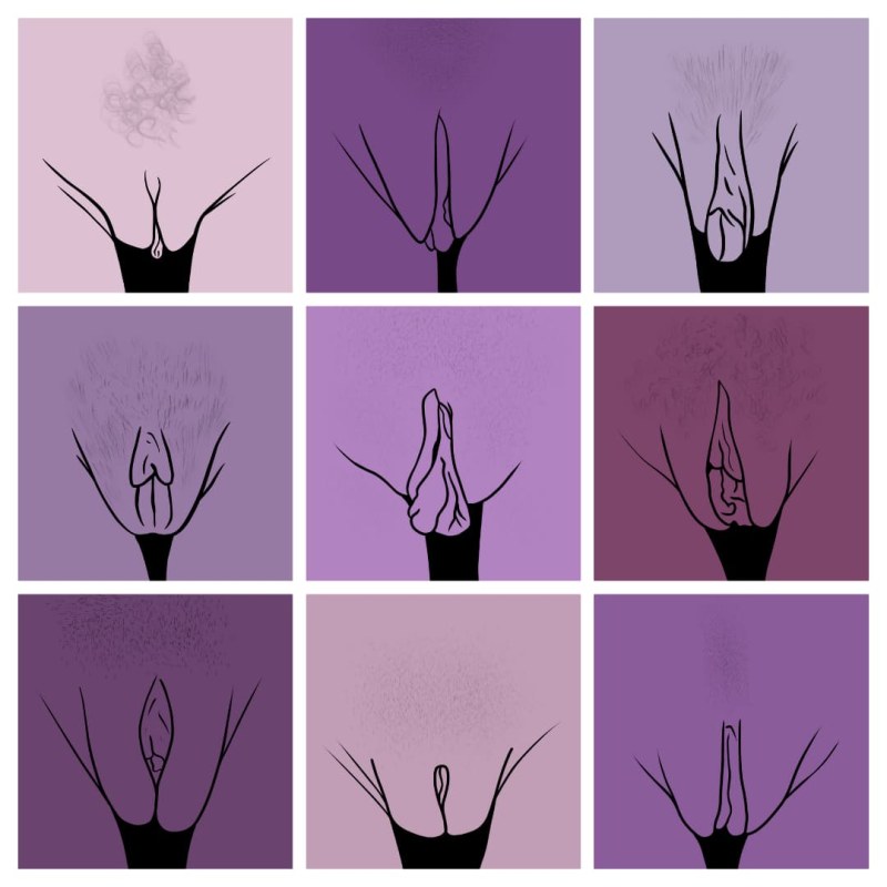 Non -standard vagina