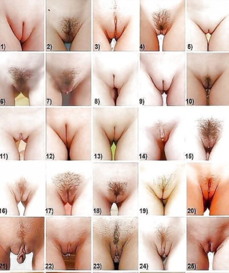 Different forms of female genitals