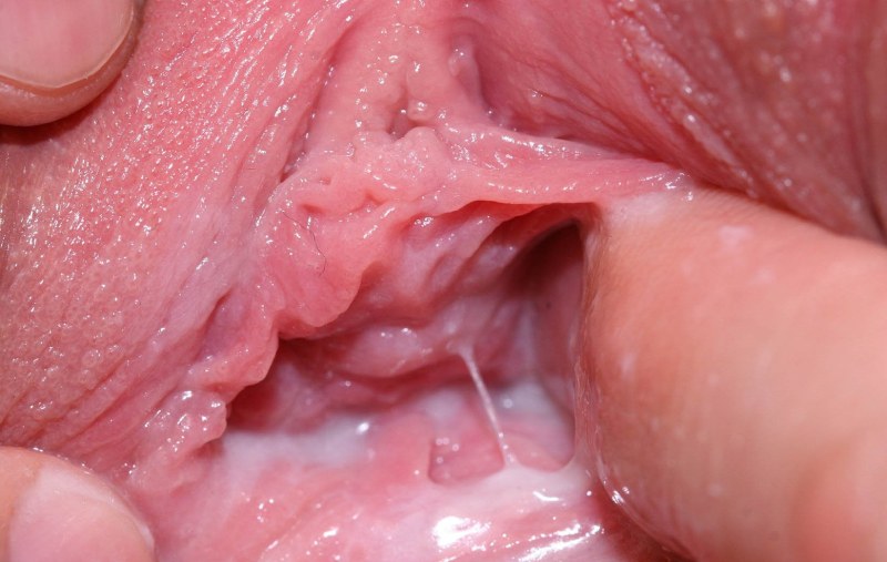 The insides of the vagina