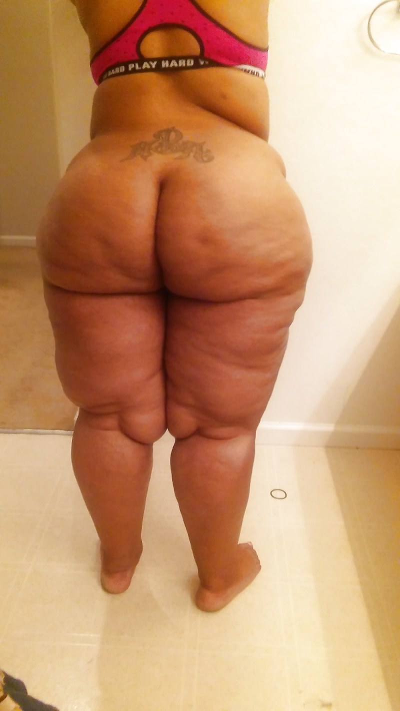 Cellulite ASS is small