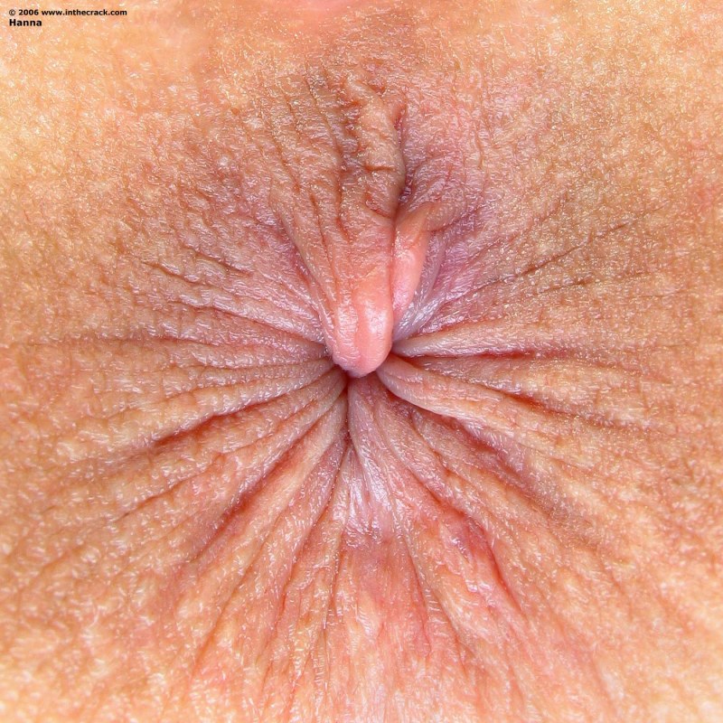 The fringe of the anus