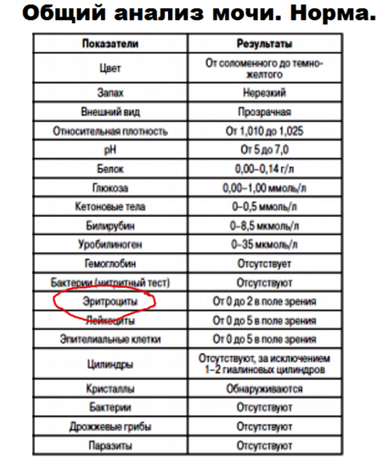 Urine analysis is norm