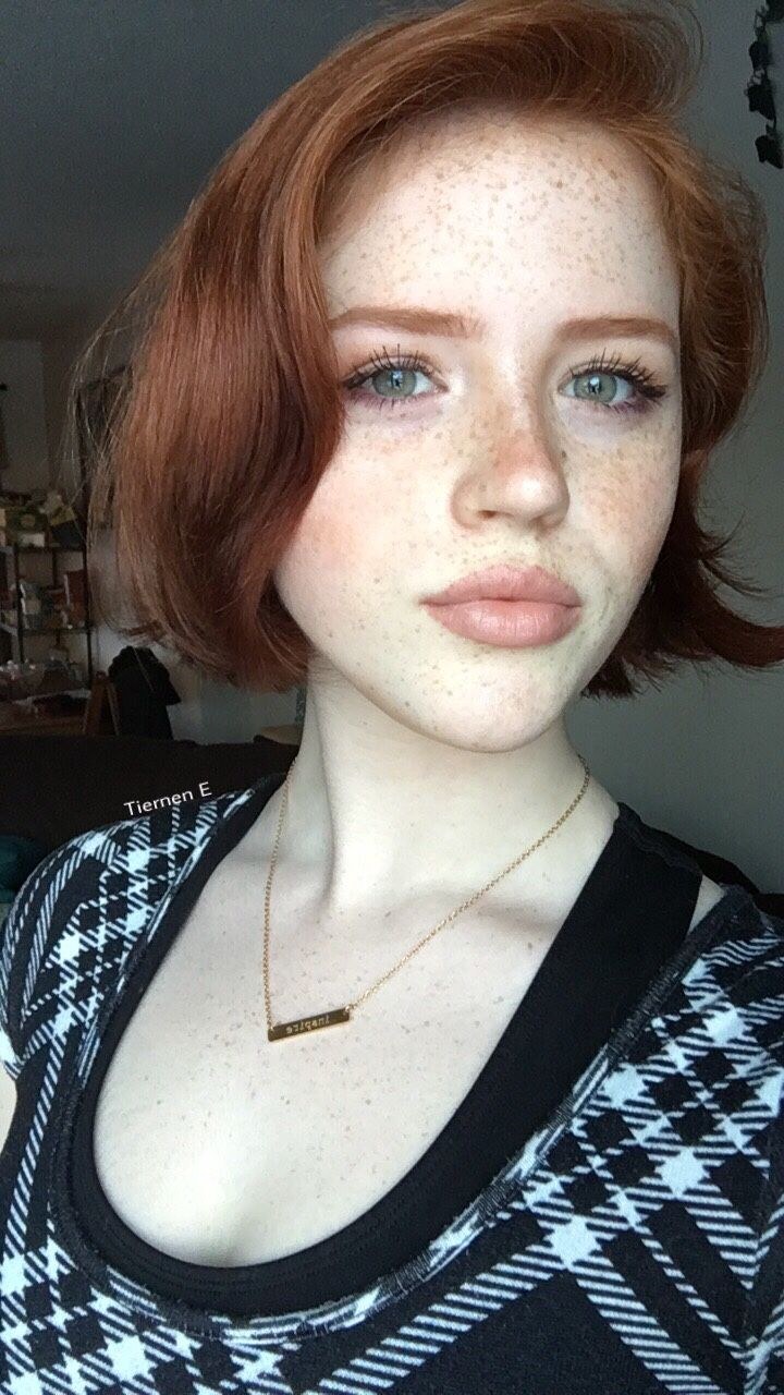 Swollen papillae
