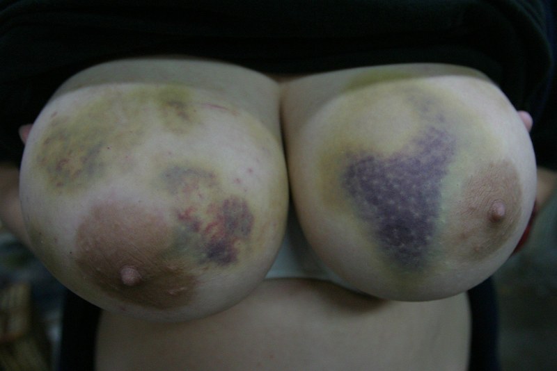 Violence of women over men