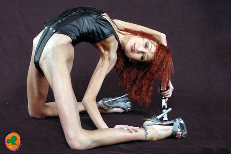 Isabelle Karo anorexia