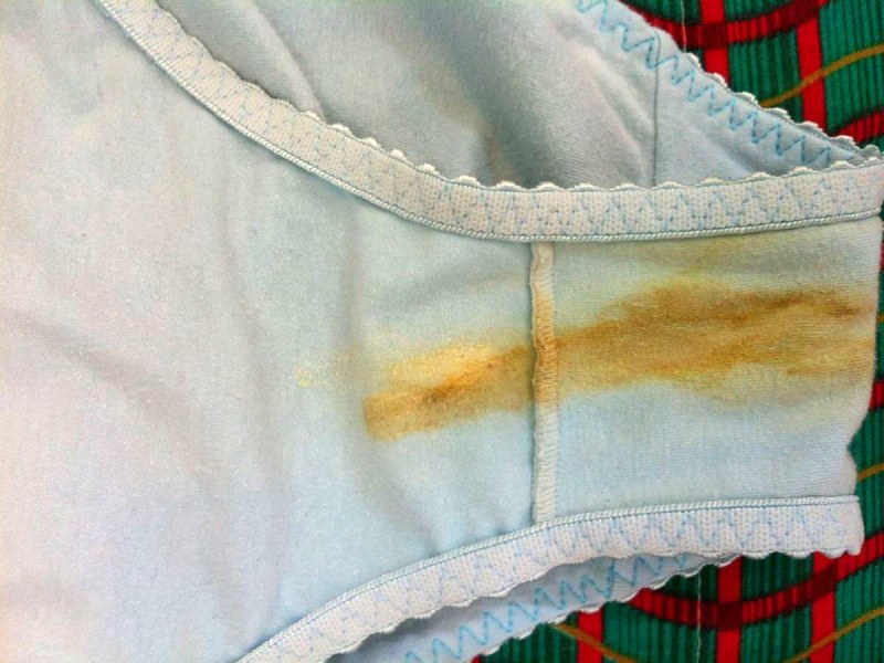 Elderly naked women in the car