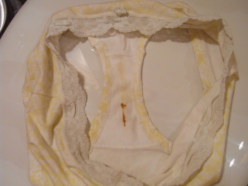 An elderly woman without panties under a skirt