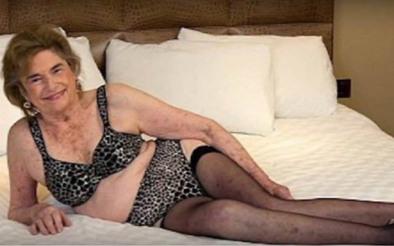 Elderly women in shorts