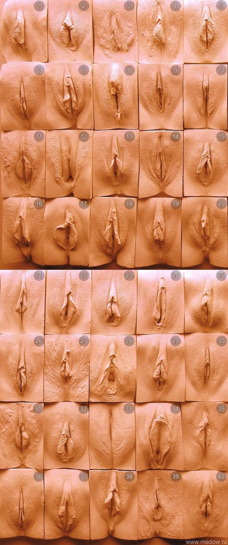 The outer part of the vagina