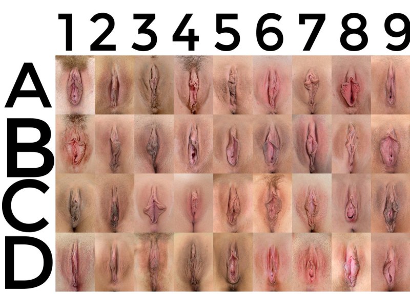 A different location of the vulva