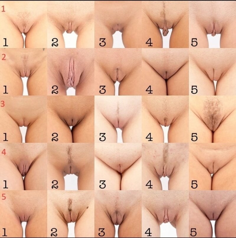 Different forms of female genitals