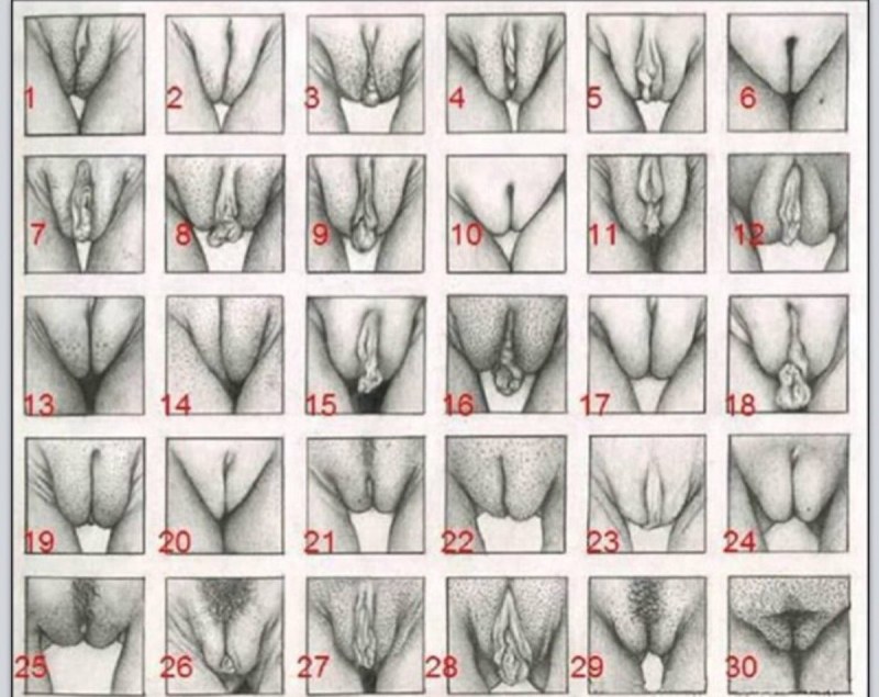 Small labia label labioplasty
