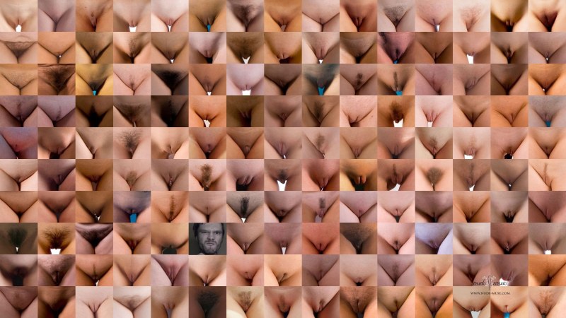 High location of the vagina