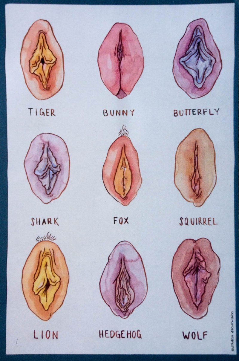 Vaginal plastic (vaginoplasty)