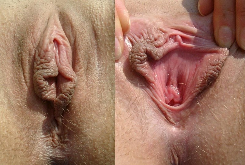 Women's vagina before and after childbirth
